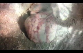 Video: Eagulls - Nerve Endings